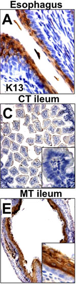 Normal esophagus (left panel), which is stained in brown for cytokeratin 13 (K13), a marker for esophageal epithelium. In the control intestine in the middle panel (CT ileum), no cytokeratin 13 is present. However, in the Cdx2 mutant intestine in the right panel (labeled MT ileum) cytokeratin is clearly visible in brown, indicating the transformation of the intestine into esophagus.